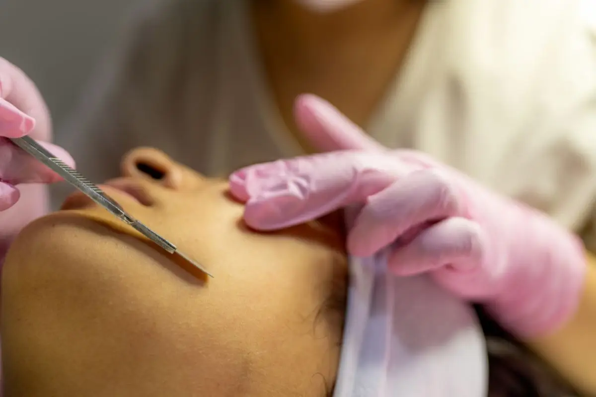 Dermaplaning Cornwall