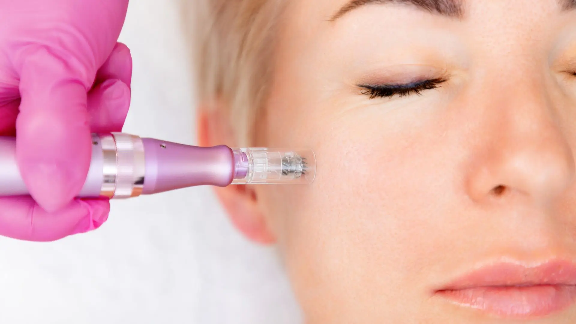 Facials Cornwall - Charlie Walker PMU